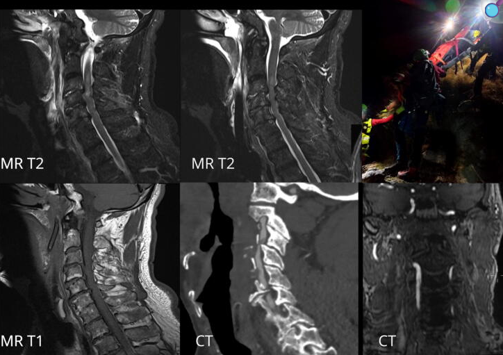 Imágenes de tomografía computarizada y resonancia magnética