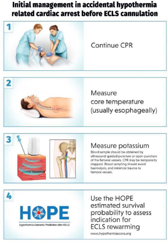 Manejo inicial del paro cardíaco accidental por hipotermia antes de la canulación del ECLS