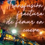 Transfusión por fractura de fémur en una cueva