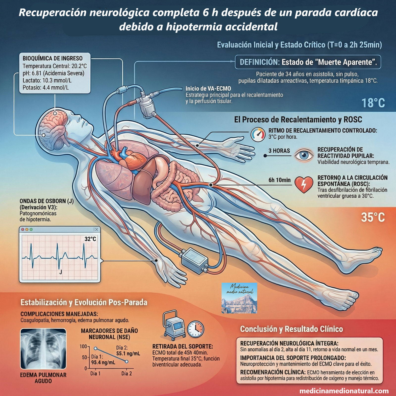 Recuperación neurológica completa 6 h después de un parada cardíaca debido a hipotermia accidental 